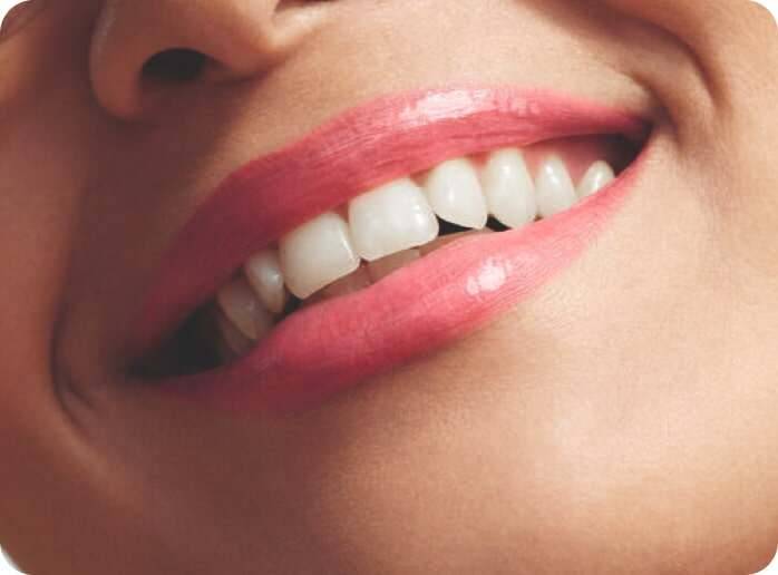 Labios sonrien colorete elixir resplandor Yves Rocher